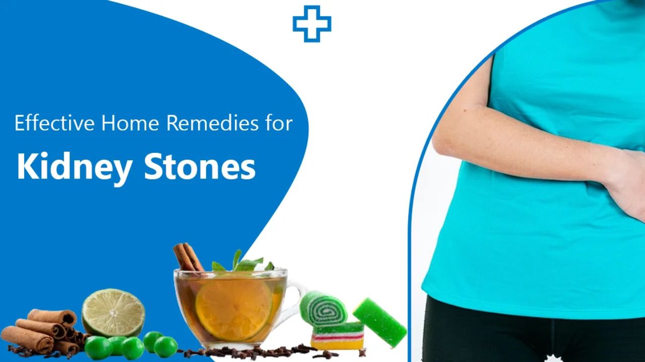 Kidney Stones