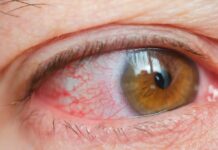 Eye Infection Causes: కంటి చుక్కలు కంటి ఇన్ఫెక్షన్ కు కారణం అవుతాయా? eye infections causes