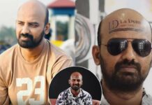 Income from baldness: బట్టతలతో ఆదాయం.. నీలాంటి ఆణిముత్యాలే దేశానికి కావాలి సామీ.. Income-from-baldness