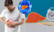 Fatty Liver: అలసట..ఆకలి తగ్గడంతో పాటు ఈ సమస్యలు ఉన్నాయా.. Fatty Liver