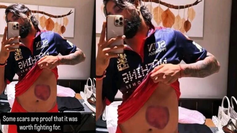 Krunal Pandya : కృణాల్ పాండ్యా.. గాయపడిన సింహం.. అతని గర్జన భయంకరం
