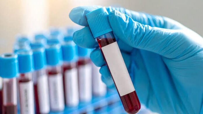 Health Tests